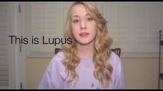 This Is Lupus