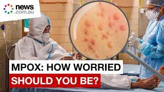 Mpox outbreak:  how worried should you be?