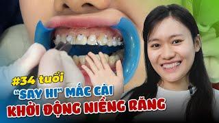 NIỀNG RĂNG KHÔNG NGẠI ĐỘ TUỔI - GẮN MẮC CÀI Ở TUỔI 34