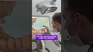 Обработка зубов и временные виниры #стоматологортопед #гнатолог #dentist #ортодонтмосква