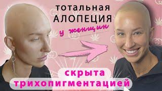 Тотальная алопеция скрыта с помощью трихопигментации.  Scalp Micropigmentation alopecia