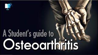 What is Osteoarthritis? An overview of its epidemiology, pathophysiology, diagnosis and treatment.