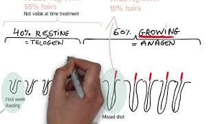 Electrolysis hair removal regrowth, time between session and total duration.