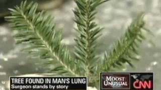 Tree Found Growing In a Man's Lungs - CNN Jeanne Moos