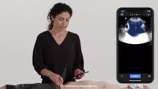 Ultrasound Education: Bladder Scanning with Butterfly iQ+