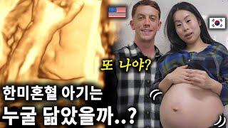 Which parent will the Korean American baby look like? 과연 한미 혼혈 아기 얼굴은 어떻게 생겼을까? 두 달 후 출산..