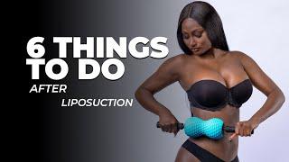 Liposuction Recovery: 6 Must-Do's for AMAZING Results