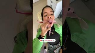 Te harías un blanqueamiento coquette??  #comedia  #humor #dientes #dentista #blanqueamiento