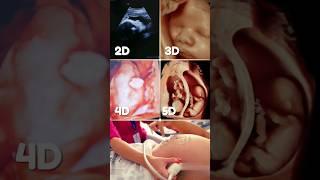 2D, 3D, 4D and 5D Pregnancy Ultrasound Scan #scan #fetalultrasound #pregnancyscan #foryou