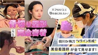 【骨切り密着#01】美容看護師がVライン形成を受けた全てを大公開！