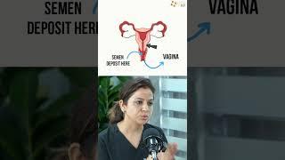IUI vs. Natural Try – Which is Better for You? Dr Rhythm Gupta - IVF Specialist at Excel IVF