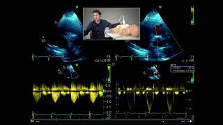 How to perform a full, comprehensive transthoracic echo study