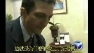 Dr. Newman 紐曼博士 幹細胞修復臉上凹洞-KABC7 (2m20s-英文中字/ChSub)