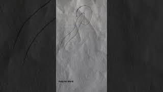 Easy girl sketch | easy drawing | Ruby Art World... #pencildrawing #art #shorts #sketch