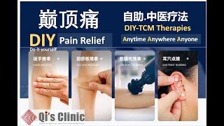 巅顶疼痛：DIY Painrelief（自助疼痛理疗）#头顶痛 #headache #headacherelief #headachetreatment #头痛