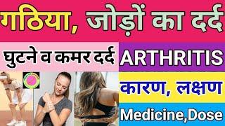 गठिया,घुटने,जोड़ो के दर्द की दवाई!MEDICINE FOR ARTHRITIS,KNEE, SPONDYLYTIS,BACK PAIN! कारण और लक्षण