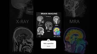 See what a human brain looks like #nursing #trending #cancer #brain