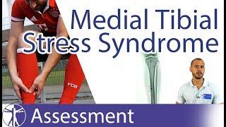 Medial Tibial Stress Syndrome / MTSS / Shin Splints