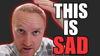 YouTuber Gets BRUTALLY TROLLED For His BALDING