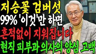 집에서 검버섯 없애는 방법 3가지 총정리 ! 피부과에 헛돈 쓰지마세요. 현직 피부과 의사가 밝힌 7일의 기적｜피부관리법｜검버섯｜검버섯 없애는 방법 ｜노후지혜｜노후준비｜건강정보