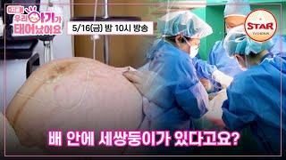 [#우리아기가태어났어요] 세쌍둥이 출산 시작, 울지 않는 아기? 2회 예고편 5/16(금) 밤 10시 방송 #TVCHOSUNSTAR
