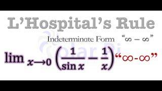 L'Hoptials Rule - [Example 4] - (Infinity minus Infinity)