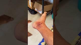 मेरा Leg  Inline Skate nhi pahan payega  #skaterboy #minivlog #vishalskater #skatevlogger #skate