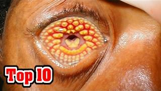 Top 10 Common Phobias You Probably Have