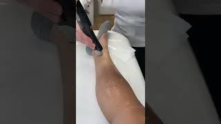 PAINLESS Laser Hair Removal