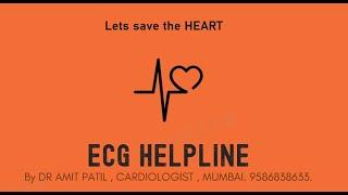 BASICS OF ECG LECTURE 1