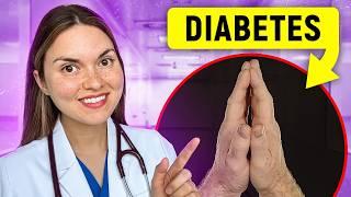 Top 10 Signs of DIABETES You Can SEE: Doctor Explains