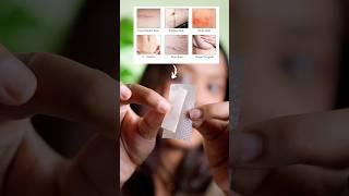 Remove Scar using this ‼️ #scarremoval #acnescars #scars