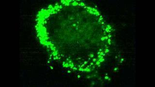 TRPC-6 expression on the surface of human alveolar macrophages