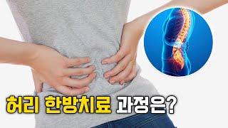 [바디올 한의원] 수술받지 않고 허리가 좋아질 수 있나요? │허리 한방 치료