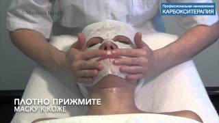 Неинвазивная карбокситерапия — маска СО2. Carboxy  CO2 mask.