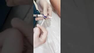 Köpük skleroterpiya tedavi damarlarin qurudulmasi istanbul NS klinika Yeni Gence Tibb Merkezi Varix
