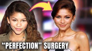 Euphoria’s Zendaya: Plastic Surgery ALMOST Natural