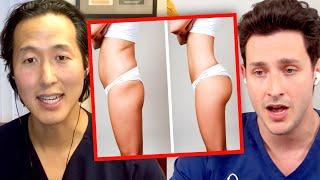 The Deadly Truth Behind Brazilian Butt Lift Surgery (BBL)