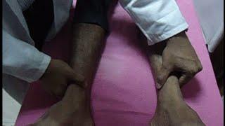 How to examine edema?