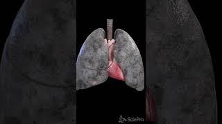 Stop smoking! Anatomy of a smoker´s lung.  #anatomy #meded #3danimation