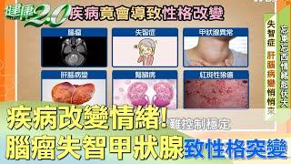 警訊!情緒憂鬱 脾氣暴躁易怒 當心腦子生病 健康2 0