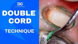 Double cord technique