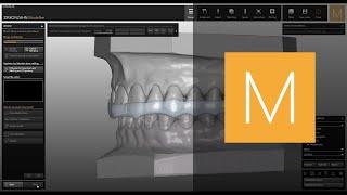 Bite Splints software module for Zirkonzahn.Modellier | Zirkonzahn.Software