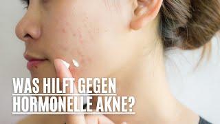 Was hilft gegen hormonelle Akne?