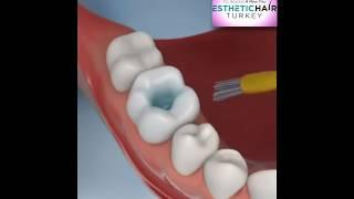 Common Dental Procedures