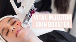 Vital Injector Skin Boosters - The Vanity Lab