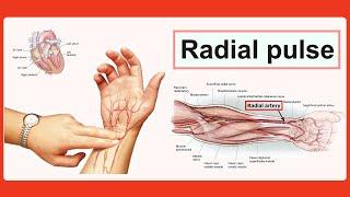 radial pulse