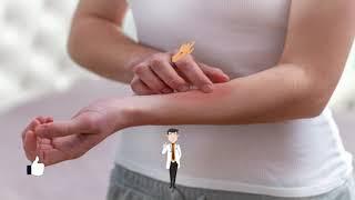 Si të mbani larg mushkonjat me këta përbërës natyralë