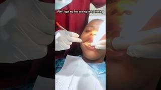 Scaling and polishing Process #youtubechamps #dentist