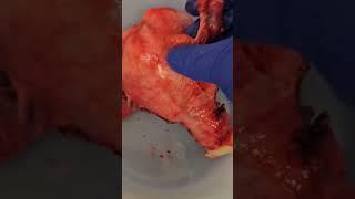UTERUS! SO CUTE! | I love anatomy 